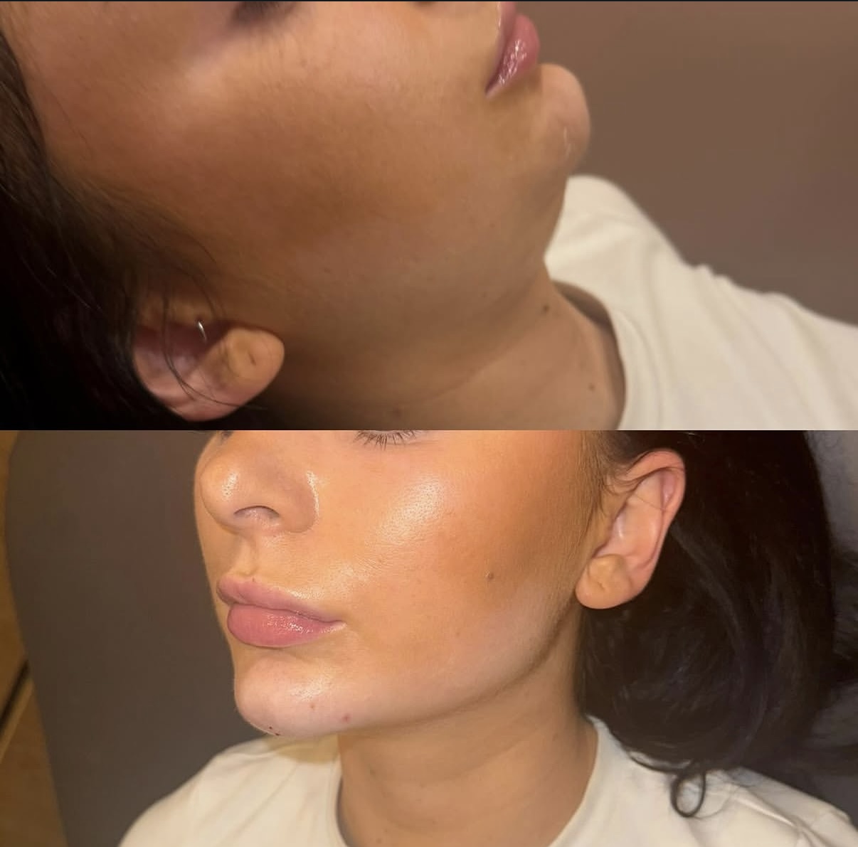 Facial balancing result